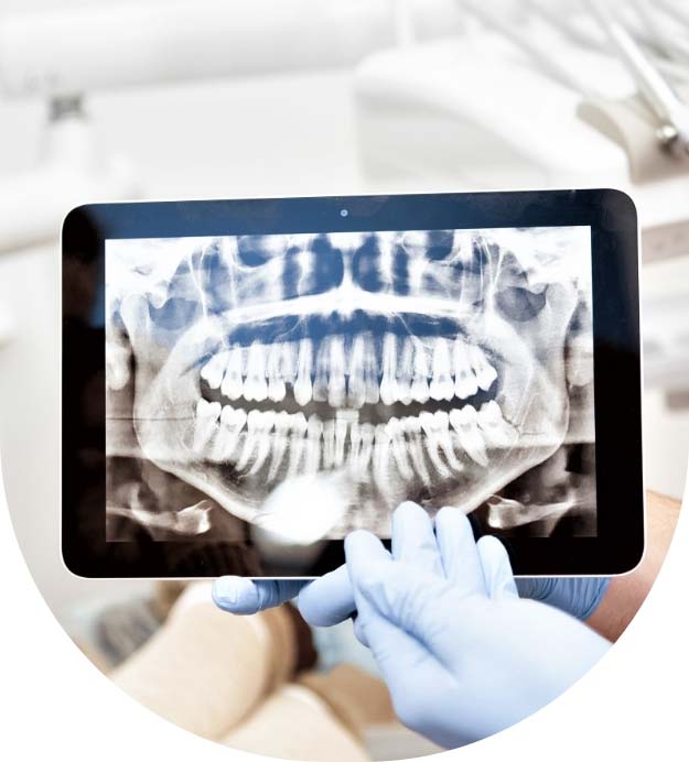 dentist with x-ray on tablet pc stock image