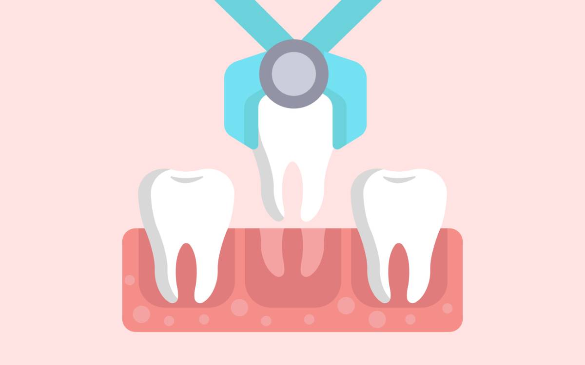 concept of preventing infection after tooth extraction