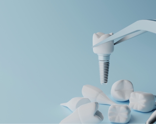 dental implant stock image