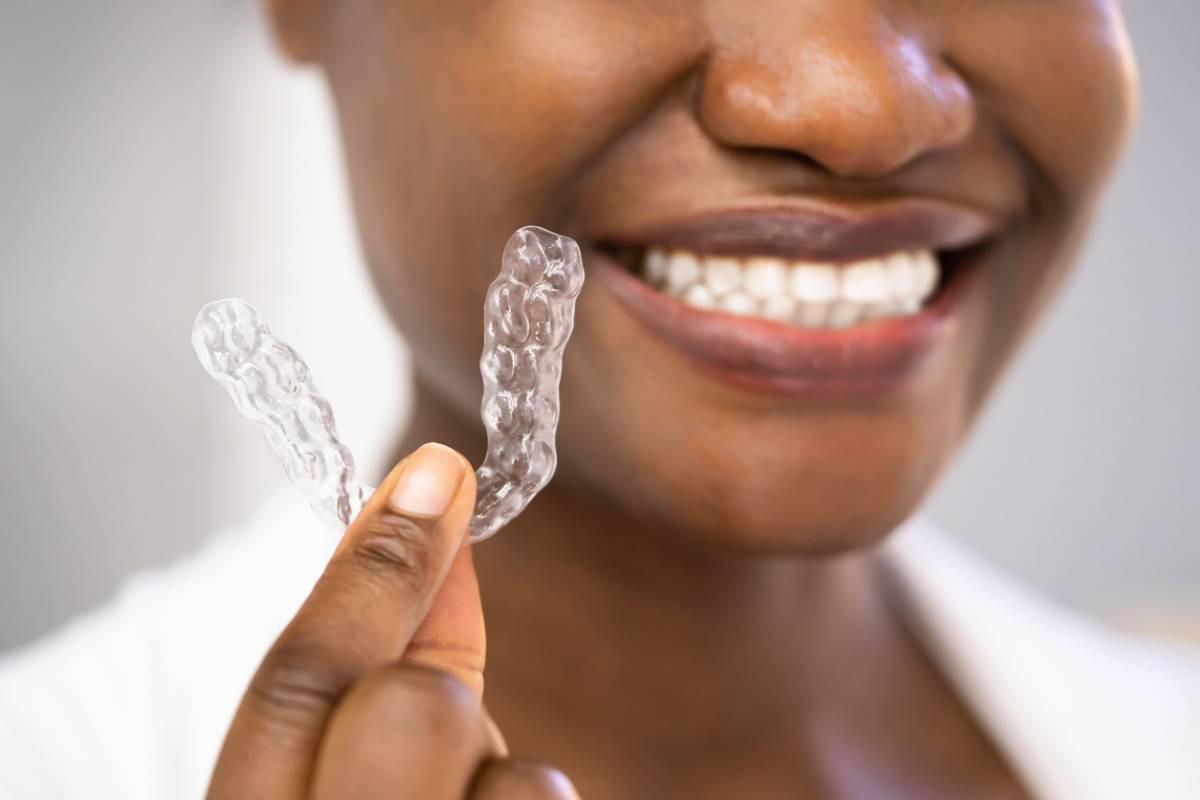 featured image for article about when will Invisalign start working
